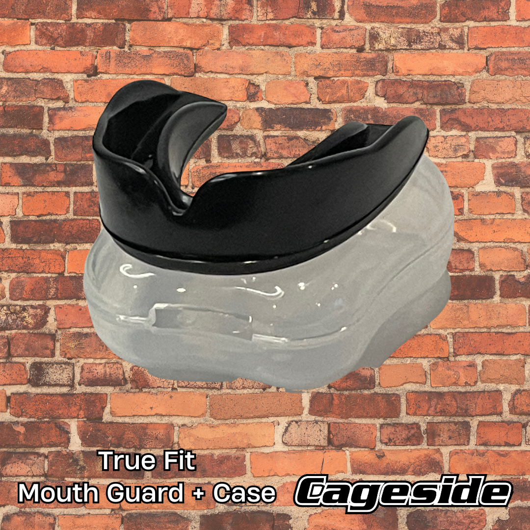 Mouth Guards